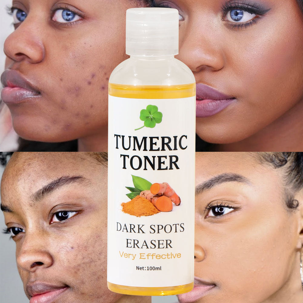 Turmeric Toner